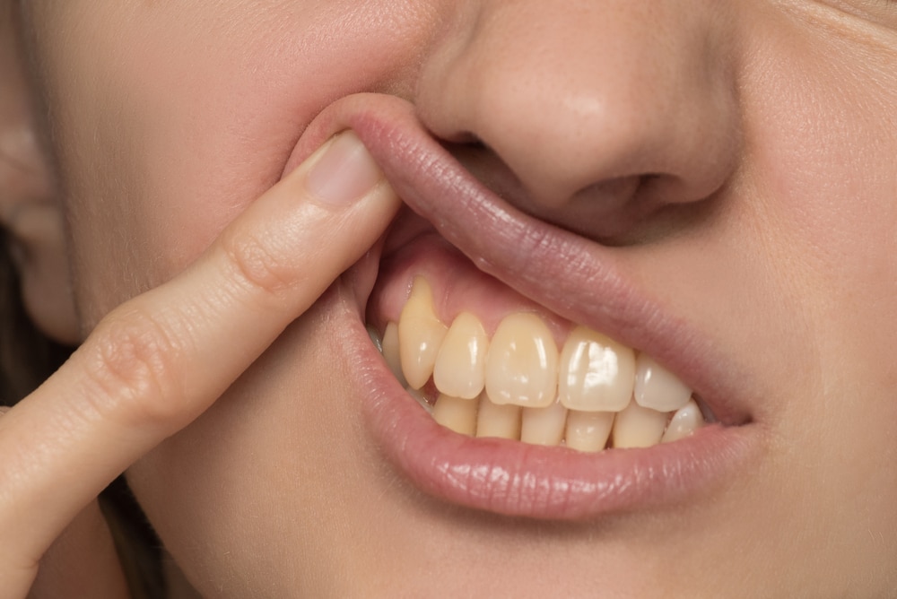 Close up of a woman's mouth with a finger on it while following a Step-by-Step Guide to Eliminating Gum Disease.